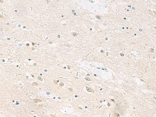 Immunohistochemistry of paraffin-embedded Human brain tissue using ANKS6 Polyclonal Antibody at dilution of 1:55(×200)