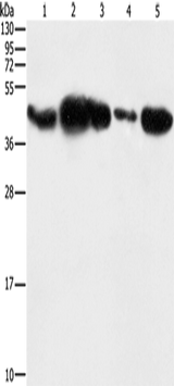 Anti-Human/Mouse/Rat PGK2 Antibody - ABMIUM