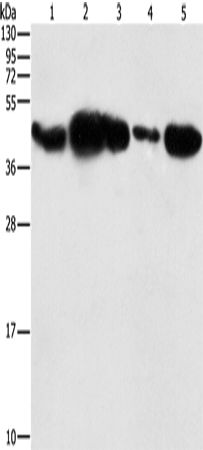 Anti-Human/Mouse/Rat PGK2 Antibody - ABMIUM