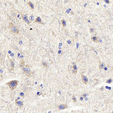Immunohistochemistry analysis of paraffin-embedded mouse spinal marrow using DLL3 Polyclonal Antibody at dilution of 1:300.