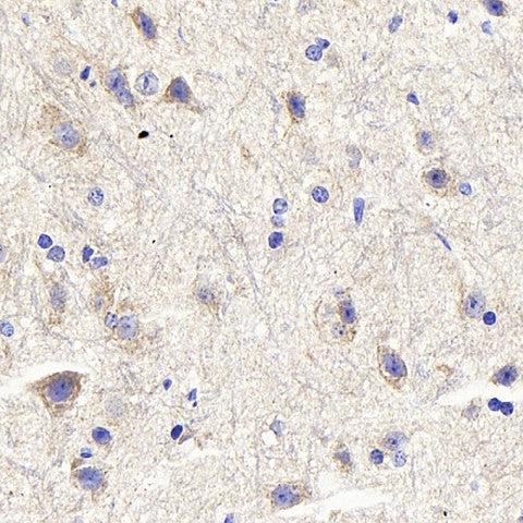 Immunohistochemistry analysis of paraffin-embedded mouse spinal marrow using DLL3 Polyclonal Antibody at dilution of 1:300.