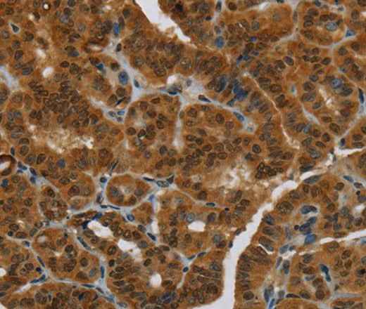 Anti-Human/Mouse/Rat MRE11A Antibody