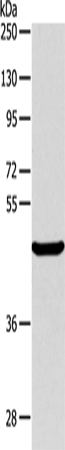 Anti-Human/Mouse ALKBH1 Antibody - ABMIUM