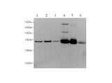 Anti-Human/Mouse/Rat ANXA5 Antibody - ABMIUM
