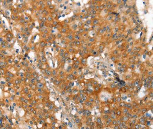 Anti-Human/Mouse/Rat MMP2 Antibody