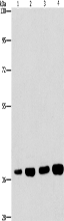 Anti-Human SERPINA9 Antibody - ABMIUM