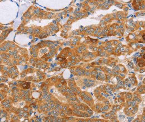 Anti-Human CARD6 Antibody