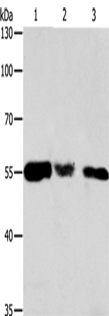 Anti-Human/Mouse/Rat CALR Antibody - ABMIUM