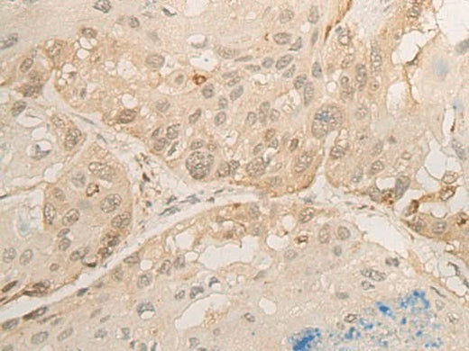 Anti-Human/Mouse DROSHA Antibody - ABMIUM