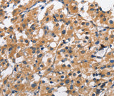 Anti-Human CLEC2D Antibody - ABMIUM