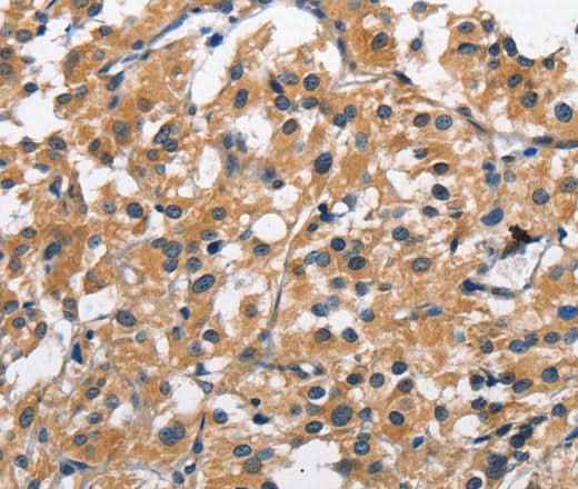 Anti-Human CLEC2D Antibody