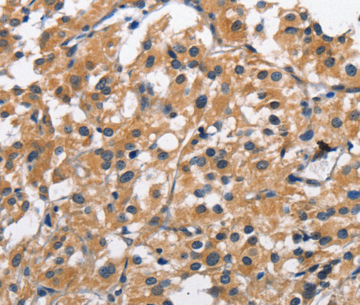 Anti-Human CLEC2D Antibody - ABMIUM