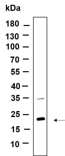 Anti-Human/Mouse/Rat CD81 Antibody [B874]