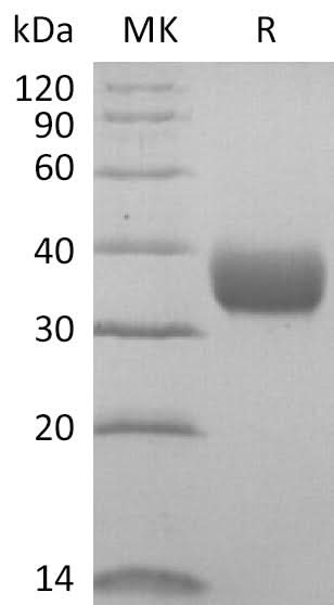 Recombinant SARS-CoV-2 Spike RBD (F342L)(His Tag) - ABMIUM