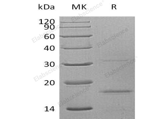 Recombinant Human CXCL9 Protein (His Tag) - ABMIUM