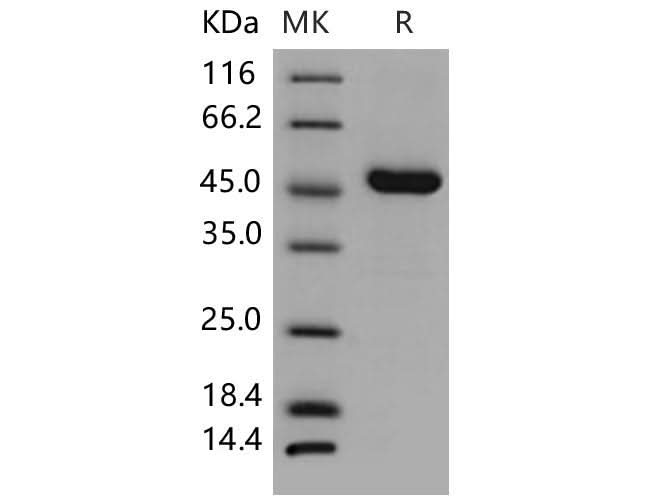 > 96 % as determined by reducing SDS-PAGE.