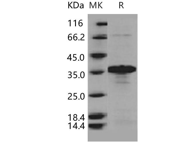 > 88 % as determined by reducing SDS-PAGE.