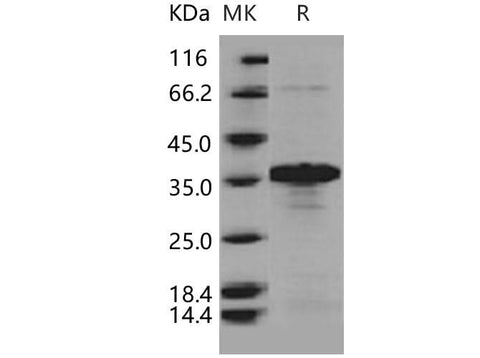 > 88 % as determined by reducing SDS-PAGE.