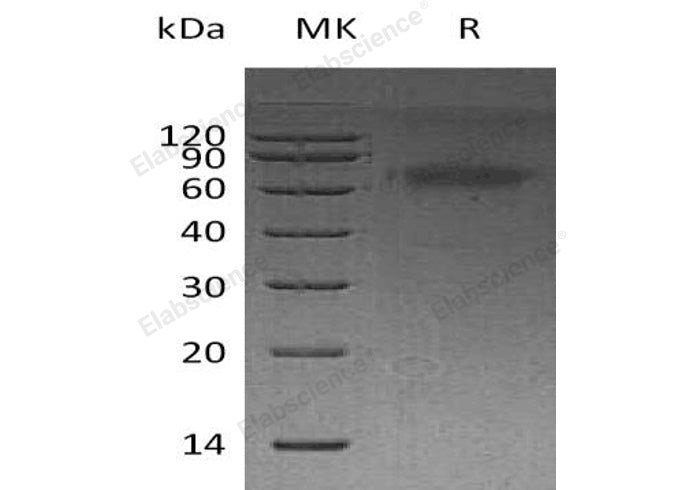 Recombinant Human DKK3 Protein (His Tag) - ABMIUM