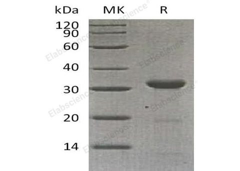 Recombinant Human Carbonic Anhydrase 10/CA10 Protein (E.coli, His Tag) - ABMIUM