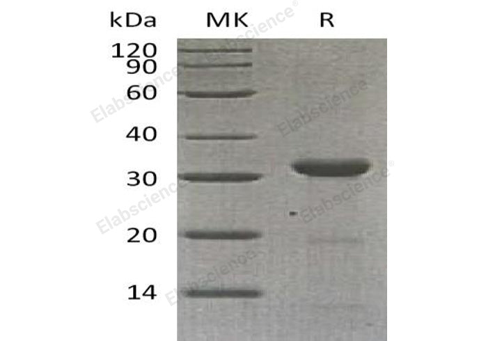 Recombinant Human Carbonic Anhydrase 10/CA10 Protein (E.coli, His Tag) - ABMIUM