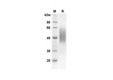 SDS-PAGE analysis of Mouse CD86 proteins, 2 μg/lane of Recombinant Mouse CD86 proteins was resolved with an SDS-PAGE under reducing conditions, showing bands at 24.2 kDa.