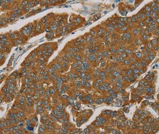 Anti-Human NPPB Antibody