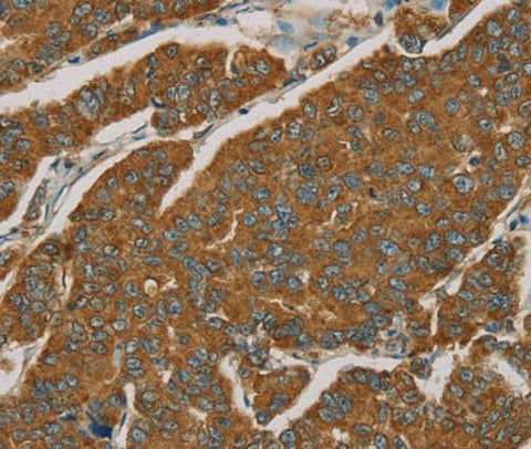 Anti-Human NPPB Antibody - ABMIUM