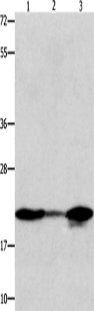 Anti-Human/Mouse/Rat NME1 Antibody - ABMIUM