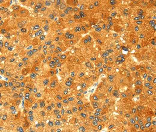 Anti-Human/Mouse/Rat GK Antibody