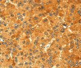 Anti-Human/Mouse/Rat GK Antibody - ABMIUM