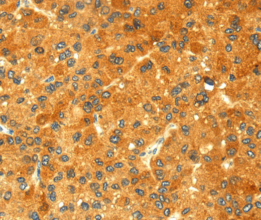 Anti-Human/Mouse/Rat GK Antibody - ABMIUM