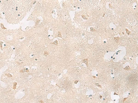 Immunohistochemistry of paraffin-embedded Human brain tissue using GPR83 Polyclonal Antibody at dilution of 1:60(×200)