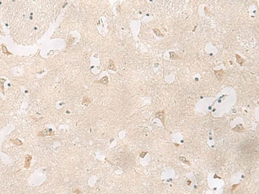 Immunohistochemistry of paraffin-embedded Human brain tissue using GPR83 Polyclonal Antibody at dilution of 1:60(×200)
