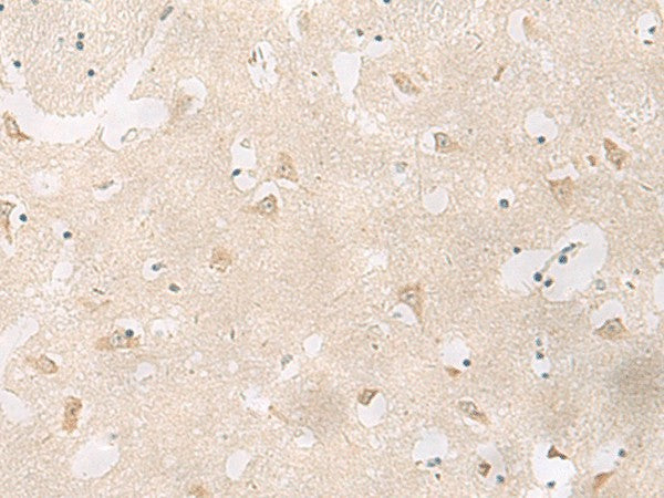 Immunohistochemistry of paraffin-embedded Human brain tissue using GPR83 Polyclonal Antibody at dilution of 1:60(×200)