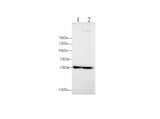 Western blot with MMP-7 Polyclonal antibody at dilution of 1:500.lane 1:HT-29 whole cell lysate, lane 2:PC-3 whole cell lysate