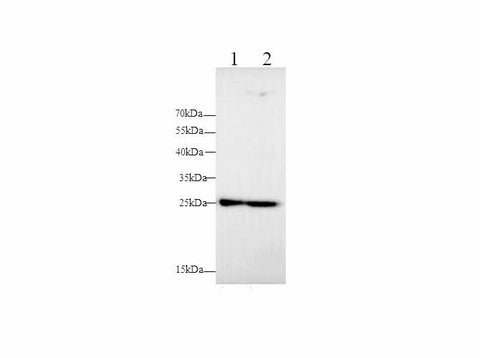 Western blot with MMP-7 Polyclonal antibody at dilution of 1:500.lane 1:HT-29 whole cell lysate, lane 2:PC-3 whole cell lysate
