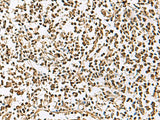 Immunohistochemistry of paraffin-embedded Human tonsil tissue using UBLCP1 Polyclonal Antibody at dilution of 1:85(×200)