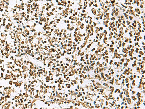 Immunohistochemistry of paraffin-embedded Human tonsil tissue using UBLCP1 Polyclonal Antibody at dilution of 1:85(×200)