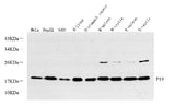 Western Blot analysis of various samples using p19 INK4d Polyclonal Antibody at dilution of 1:500.