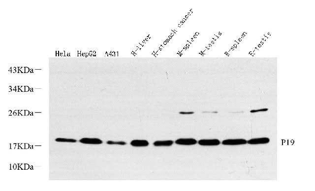 Western Blot analysis of various samples using p19 INK4d Polyclonal Antibody at dilution of 1:500.
