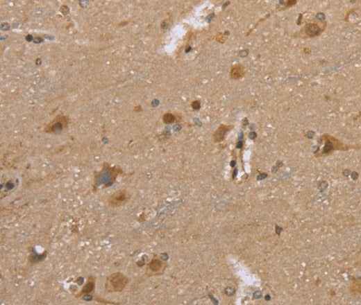 Anti-Human/Mouse/Rat DLD Antibody