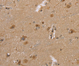Anti-Human/Mouse/Rat DLD Antibody - ABMIUM