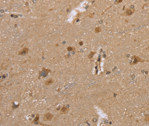 Anti-Human/Mouse/Rat DLD Antibody - ABMIUM