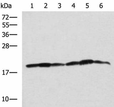 Western blot analysis of 293T K562 and HepG2 cell lysates using BLOC1S6 Polyclonal Antibody at dilution of 1:650