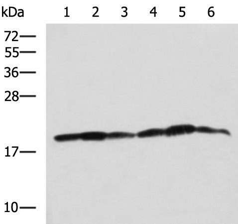 Western blot analysis of 293T K562 and HepG2 cell lysates using BLOC1S6 Polyclonal Antibody at dilution of 1:650