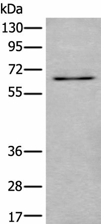 Western blot analysis of SKOV3 cell lysate using UBQLN2 Polyclonal Antibody at dilution of 1:500
