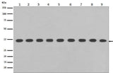 Anti-GAPDH Rabbit Monoclonal Antibody Boster Bio