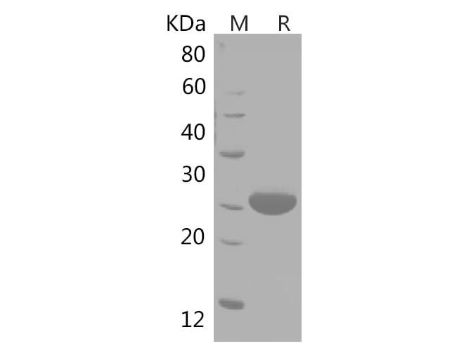 SDS-PAGE analysis of Human ACTN1 proteins, 2 μg/lane of Recombinant Human ACTN1 proteins was resolved with SDS-PAGE under reducing conditions, showing bands at 33 kDa.