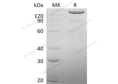 Recombinant Human BCAN Protein (His Tag) - ABMIUM